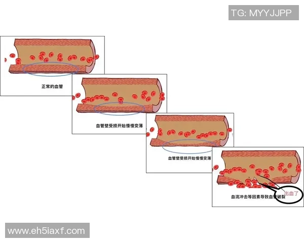 踢足球时意外受伤出血的原因与预防措施探讨